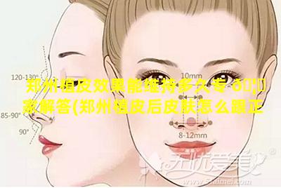 郑州植皮效果能维持多久专 🦋 家解答(郑州植皮后皮肤怎么跟正常皮肤一样)